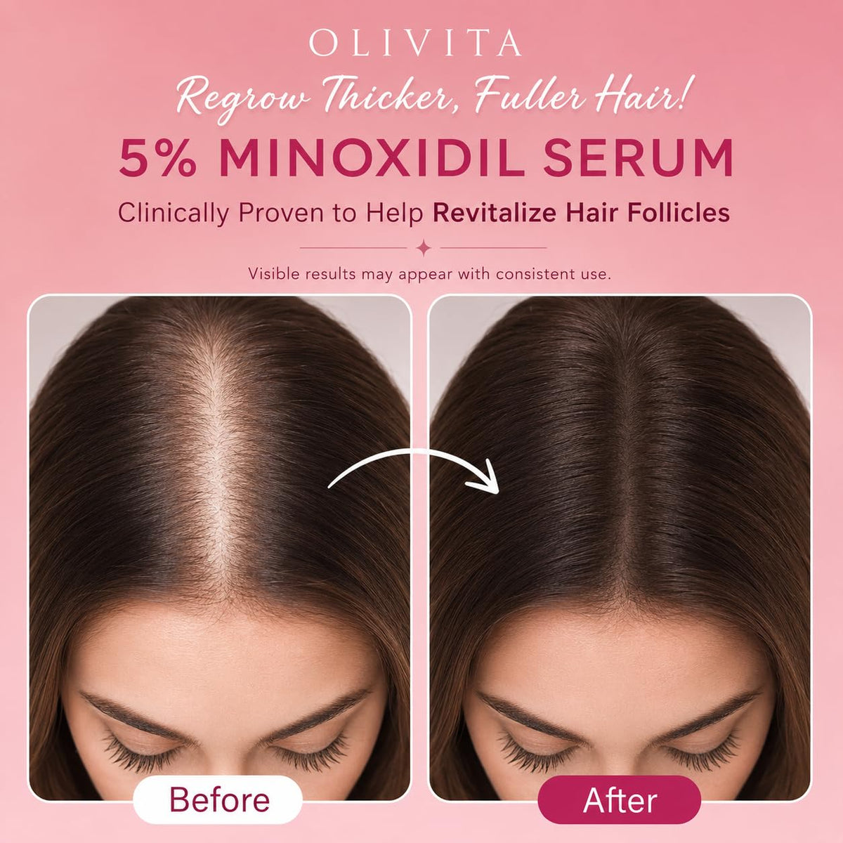 OLIVITA 5