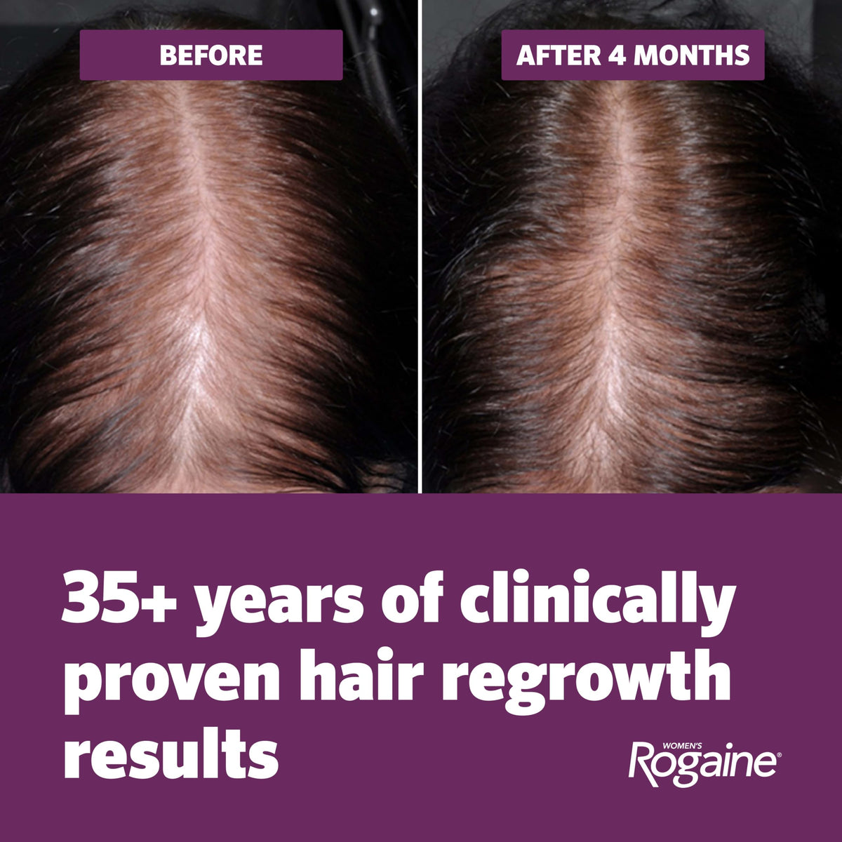Rogaine 4